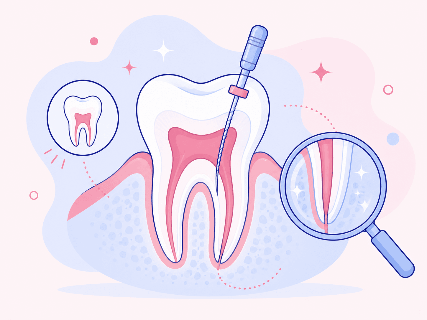 Endodoncija